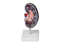 Модель почки в разрезе - fgospostavki.ru - Рязань