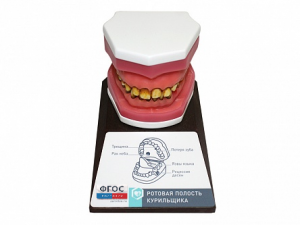 Демонстрационная модель "Ротовая полость курильщика" - fgospostavki.ru - Рязань