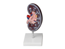 Модель почки в разрезе - fgospostavki.ru - Рязань