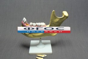 Модель "Челюсть разборная" - fgospostavki.ru - Рязань